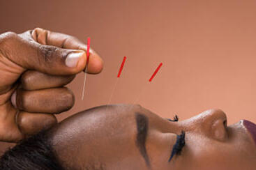 Black People Can Make A Point In The Acupuncture Enterprise